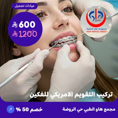 (Installation of American braces for both jaws) at At How Medical Center, Rawdah District
