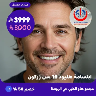 (Hollywood smile 16 teeth zirconium) At How Medical Center, Rawdah District
