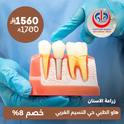 (Dental Implant Session) at Haw Medical , Al Naseem District.