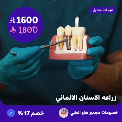 German dental implants (Offer provided by How Medical Complex)