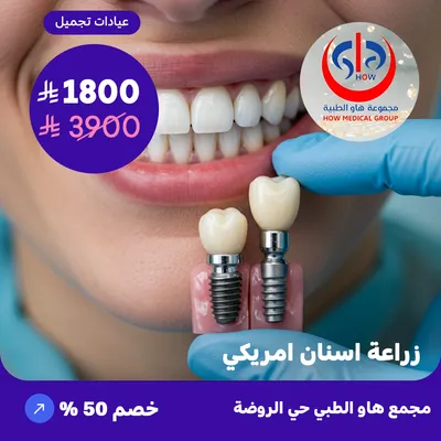 (زراعة اسنان امريكي) لدى هاو الطبي حي الروضة