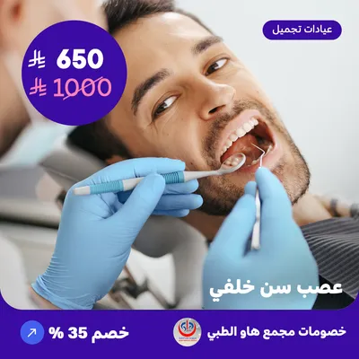 Posterior tooth nerve (Offer provided by How Medical Complex)