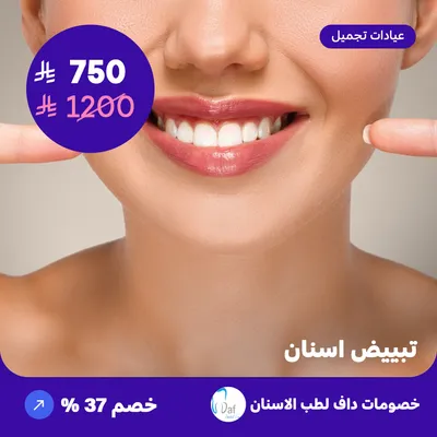 ( احصل على جلسة تبييض الاسنان بالليزر )