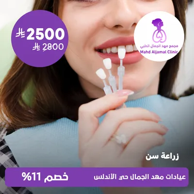 (Tooth implant) at Mahd Al Jamal Clinics, Al Andalus District