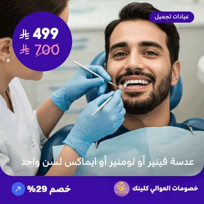 عدسة فينير أو لومنير أو ايماكس لسن واحد (عرض مقدم من العوالي كلينيك)