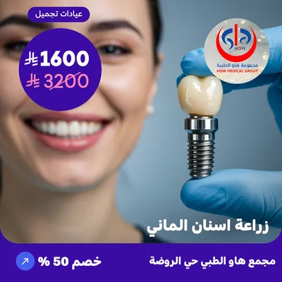 (German dental implants) At How Medical Center, Rawdah District