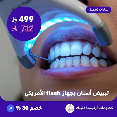 تبييض اسنان بجهاز فلاش الامريكي (عرض مقدم من ارتيستا كلينك)