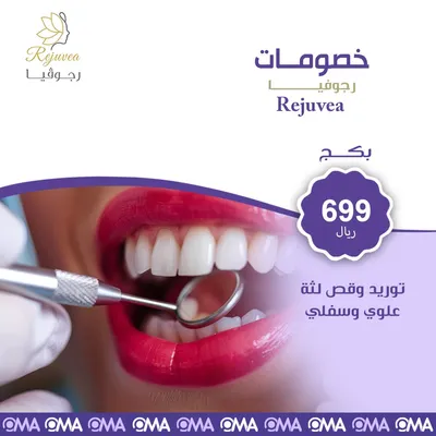 توريد وقص لثة علوي وسفلي من رجوفيا كلينيك