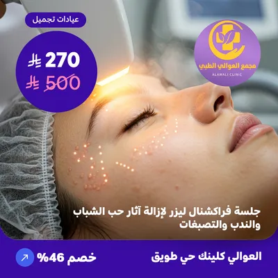 Fractional laser session to remove acne scars, scars, and pigmentation (Al-Awali Complex, Tuwaiq District)