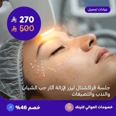 جلسة فراكشنال ليزر لإزالة آثار حب الشباب والندب والتصبغات (عرض مقدم من العوالي كلينيك)