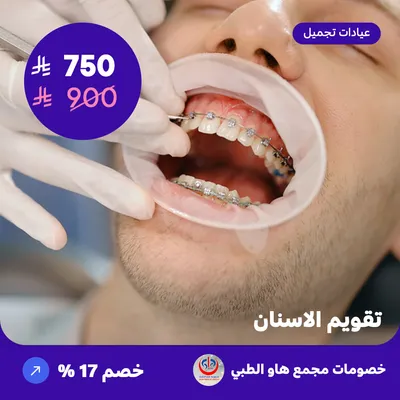 Orthodontics (Offer provided by How Medical Complex)