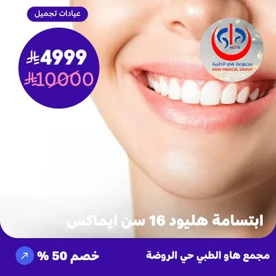 (Hollywood smile 16 teeth Emax) At How Medical Center, Rawdah District
