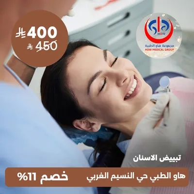 (تبييض الاسنان) لدى هاو الطبي حي النسيم 