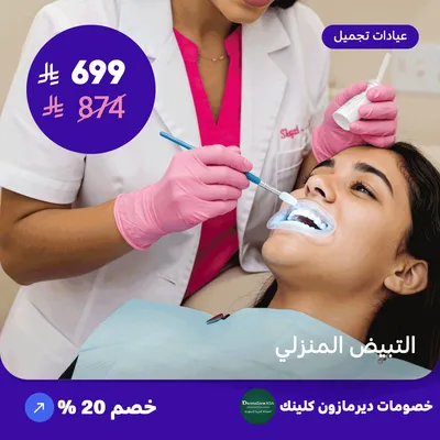 Home bleaching (Offer provided by Dermazone Clinic)