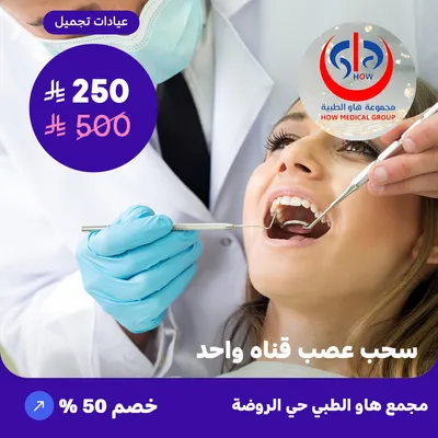 (single canal nerve extraction) At How Medical Center, Rawdah District