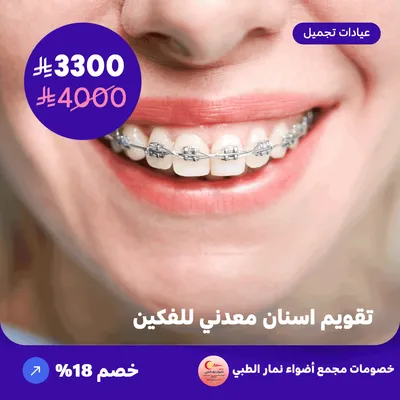 Metal braces for both jaws (Offer provided by Adawa Namar Clinic)