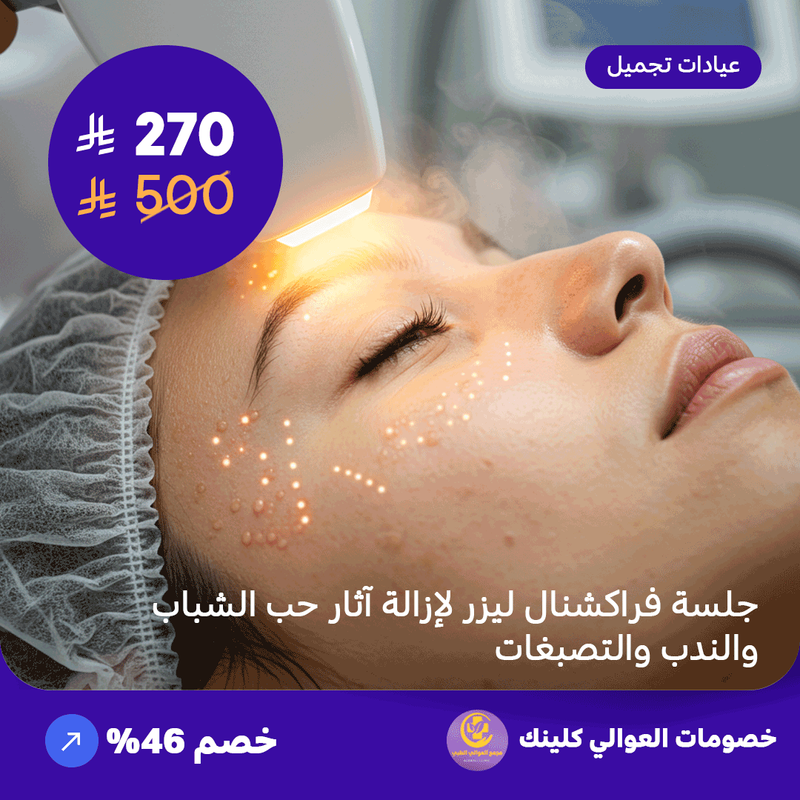 جلسة فراكشنال ليزر لإزالة آثار حب الشباب والندب والتصبغات (عرض مقدم من العوالي كلينيك)